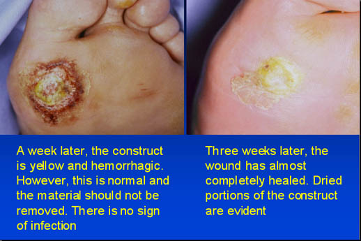 A week later and 3 weeks later