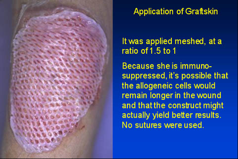 Application of Graftskin