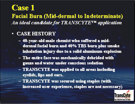 Case 1-Facial burn