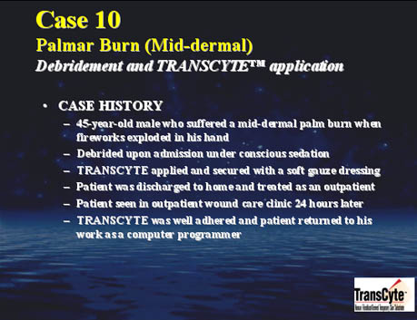 Case 10- Palmar burn