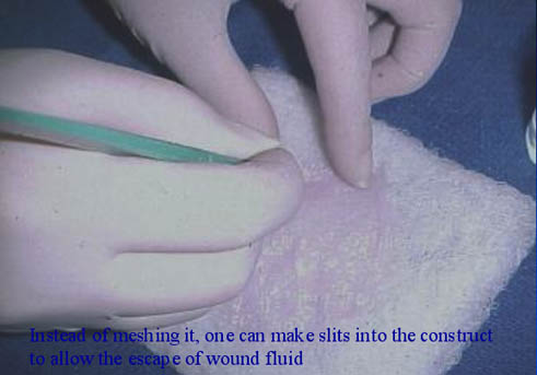 Making slits into the construct