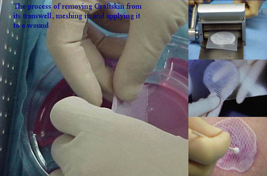 The process of removing Graftskin from its transwell
