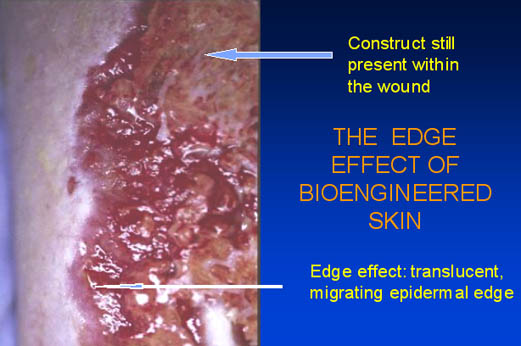 The edge effect of bioengineered skin